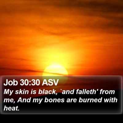 Job 30:30 ASV Bible Verse Image