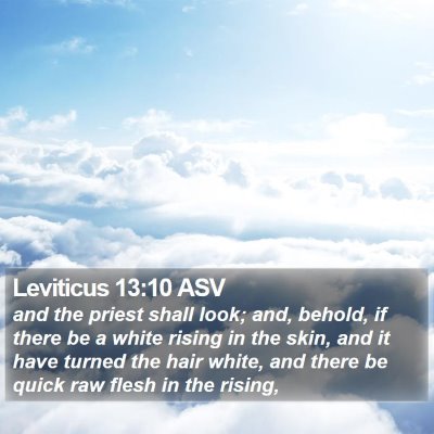 Leviticus 13:10 ASV Bible Verse Image