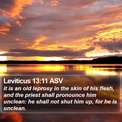 Leviticus 13:11 ASV Bible Verse Image