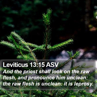 Leviticus 13:15 ASV Bible Verse Image