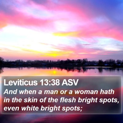 Leviticus 13:38 ASV Bible Verse Image