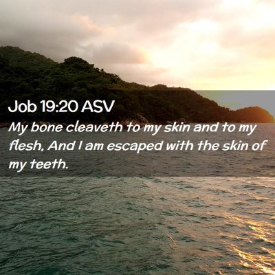 Picture 02 - Job 19:20 ASV - My bone cleaveth to my skin and to my flesh, And - Bible Verse Picture