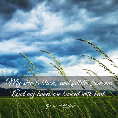 Picture 03 - Job 30:30 ASV - My skin is black, `and falleth' from me, And my - Bible Verse Picture