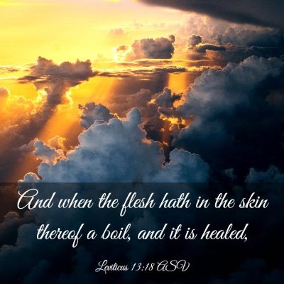 Picture 03 - Leviticus 13:18 ASV - And when the flesh hath in the skin thereof a - Bible Verse Picture