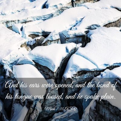 Picture 03 - Mark 7:35 ASV - And his ears were opened, and the bond of his - Bible Verse Picture