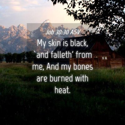 Picture 04 - Job 30:30 ASV - My skin is black, `and falleth' from me, And my - Bible Verse Picture