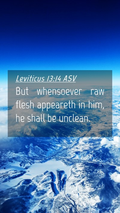 Picture 04 - Leviticus 13:14 ASV Mobile Phone Wallpaper - But whensoever raw flesh appeareth in him, he - Mobile Bible Verse Wallpaper